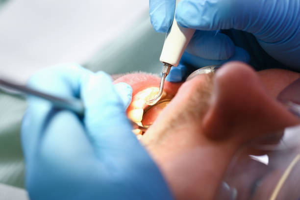 Best Tooth Infection Emergency Dentist  in Augusta, KS