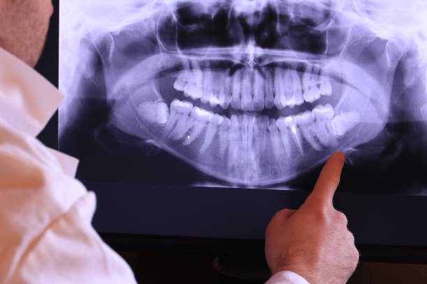 Best Dentist for Tooth Abscess  in Augusta, KS