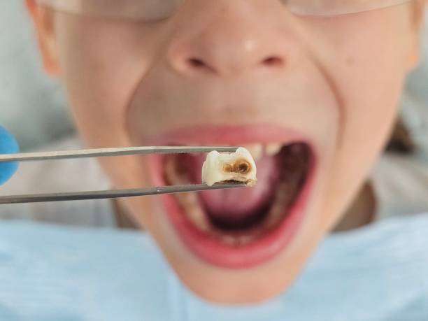 Emergency Dentist Open Today in KS